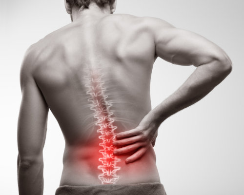Rückenschmerzen sind ein weit verbreitetes Gesundheitsproblem